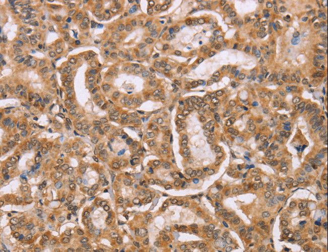 Osteocalcin Antibody - Immunohistochemistry of paraffin-embedded Human brain using BGLAP Polyclonal Antibody at dilution of 1:40.