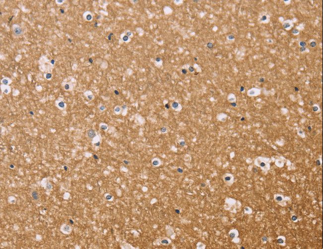 Osteocalcin Antibody - Immunohistochemistry of paraffin-embedded Human brain using BGLAP Polyclonal Antibody at dilution of 1:40.