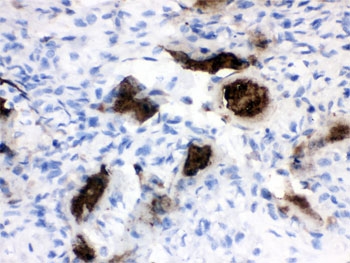 Osteocalcin Antibody