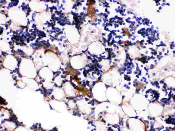 Osteocalcin Antibody - Osteocalcin was detected in paraffin-embedded sections of mouse tibia tissues using rabbit anti-Osteocalcin Antigen Affinity purified polyclonal antibody