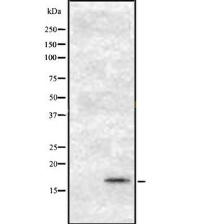 Osteocalcin Antibody - Western blot analysis Osteocalcin using K562 whole cells lysates