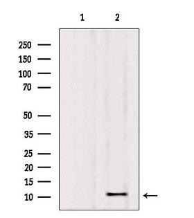 Osteocalcin Antibody - Western blot analysis of extracts of rat brain tissue using Osteocalcin antibody. Lane 1 was treated with the blocking peptide.