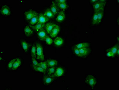 Osteoglycin / Mimecan Antibody - Immunofluorescence staining of HepG2 cells with OGN Antibody at 1:100, counter-stained with DAPI. The cells were fixed in 4% formaldehyde, permeabilized using 0.2% Triton X-100 and blocked in 10% normal Goat Serum. The cells were then incubated with the antibody overnight at 4°C. The secondary antibody was Alexa Fluor 488-congugated AffiniPure Goat Anti-Rabbit IgG(H+L).