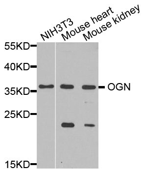 Osteoglycin / Mimecan Antibody - Western blot blot of extracts of various cell lines, using OGN antibody.