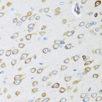 Osteoglycin / Mimecan Antibody - Immunohistochemistry of paraffin-embedded rat brain using OGN antibody at dilution of 1:100 (40x lens).