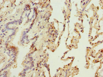 Osteoglycin / Mimecan Antibody - Immunohistochemistry of paraffin-embedded human lung tissue at dilution 1:100