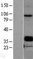 Osteoglycin / Mimecan Protein - Western validation with an anti-DDK antibody * L: Control HEK293 lysate R: Over-expression lysate