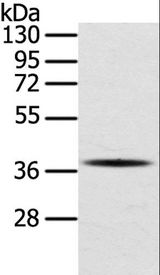 Osteonectin / SPARC Antibody - Western blot analysis of A375 cell, using SPARC Polyclonal Antibody at dilution of 1:400.