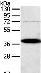 Osteonectin / SPARC Antibody - Western blot analysis of A375 cell, using SPARC Polyclonal Antibody at dilution of 1:500.