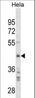 Osteonectin / SPARC Antibody - SPARC Antibody (Ascites)western blot of HeLa cell line lysates (35 ug/lane). The SPARC antibody detected the SPARC protein (arrow).