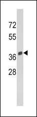 Osteonectin / SPARC Antibody - Western blot of SPARC Antibody in Y79 cell line lysates (35 ug/lane). SPARC (arrow) was detected using the purified antibody.