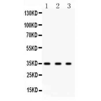 Osteonectin / SPARC Antibody - SPARC antibody Western blot. All lanes: Anti SPARC at 0.5 ug/ml. Lane 1: HELA Whole Cell Lysate at 40 ug. Lane 2: 293T Whole Cell Lysate at 40 ug. Lane 3: MCF-7 Whole Cell Lysate at 40 ug. Predicted band size: 35 kD. Observed band size: 35 kD.