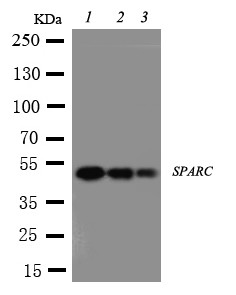 Osteonectin / SPARC Antibody - WB of Osteonectin / SPARC antibody. Lane 1: Recombinant Human SPARC Protein 10ng. Lane 2: Recombinant Human SPARC Protein 5ng. Lane 3: Recombinant Human SPARC Protein 2.5ng.