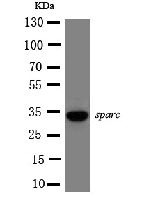 Osteonectin / SPARC Antibody - WB of Osteonectin / SPARC antibody. All lanes: Anti-SPARC at 0.5ug/ml. WB: HELA Whole Cell Lysate at 40ug. Predicted bind size: 35KD. Observed bind size: 35KD.