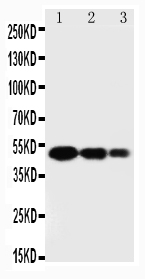 Osteonectin / SPARC Antibody - Anti-SPARC antibody, Western blotting Lane 1: Recombinant Human SPARC Protein 10ng Lane 2: Recombinant Human SPARC Protein 5ng Lane 3: Recombinant Human SPARC Protein 2. 5ng