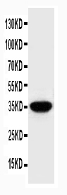 Osteonectin / SPARC Antibody - Anti-SPARC antibody, Western blottingWB: HELA Cell Lysate