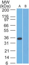Osteonectin / SPARC Antibody - Western Blot: SPARC Antibody - analysis of human A375 lysate probed with SPARC antibody at 2 ug/ml. goat anti-rabbit Ig HRP secondary antibody and PicoTect ECL substrate solution were used for this test.