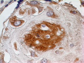 Osteonectin / SPARC Antibody - Immunohistochemistry-Paraffin: SPARC Antibody - Formalin-fixed, paraffin-embedded human placenta tissue stained with SPARC antibody (5 ug/ml), peroxidase-conjugate and DAB chromogen.