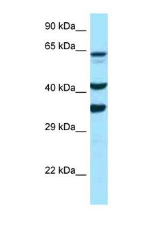 Osteonectin / SPARC Antibody - SPARC / Osteonectin antibody western blot of PANC1 cell lysate. Antibody concentration 1 ug/ml.  This image was taken for the unconjugated form of this product. Other forms have not been tested.