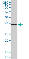 Osteonectin / SPARC Antibody - SPARC monoclonal antibody (M02), clone 1B2. Western Blot analysis of SPARC expression in human kidney.