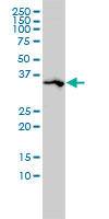 Osteonectin / SPARC Antibody - SPARC monoclonal antibody (M02), clone 1B2 Western Blot analysis of SPARC expression in A-431.