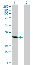 Osteonectin / SPARC Antibody - Western Blot analysis of SPARC expression in transfected 293T cell line by SPARC monoclonal antibody (M02), clone 1B2.Lane 1: SPARC transfected lysate(34.6 KDa).Lane 2: Non-transfected lysate.