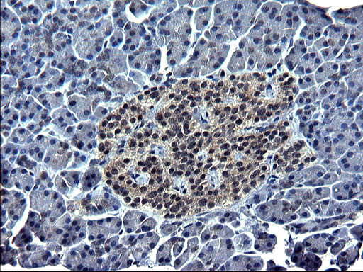 Osteonectin / SPARC Antibody - IHC of paraffin-embedded Human pancreas tissue using anti-SPARC mouse monoclonal antibody. (Heat-induced epitope retrieval by 1 mM EDTA in 10mM Tris, pH8.5, 120°C for 3min).