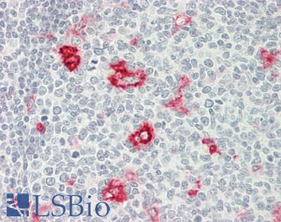 Osteonectin / SPARC Antibody - Human Tonsil: Formalin-Fixed, Paraffin-Embedded (FFPE)