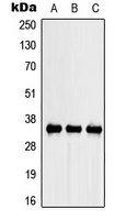 Osteonectin / SPARC Antibody - Western blot analysis of SPARC expression in A549 (A); NIH3T3 (B); PC12 (C) whole cell lysates.