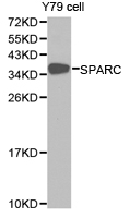 Osteonectin / SPARC Antibody - Western blot of extracts of Y79 cell lines, using SPARC antibody.