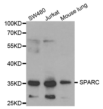 Osteonectin / SPARC Antibody - Western blot analysis of extracts of various cell lines, using SPARC antibody at 1:1000 dilution. The secondary antibody used was an HRP Goat Anti-Rabbit IgG (H+L) at 1:10000 dilution. Lysates were loaded 25ug per lane and 3% nonfat dry milk in TBST was used for blocking.