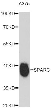 Osteonectin / SPARC Antibody - Western blot analysis of extracts of A375 cells, using SPARC antibody at 1:3000 dilution. The secondary antibody used was an HRP Goat Anti-Rabbit IgG (H+L) at 1:10000 dilution. Lysates were loaded 25ug per lane and 3% nonfat dry milk in TBST was used for blocking. An ECL Kit was used for detection and the exposure time was 90s.