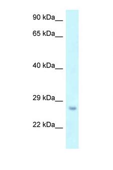 OSTF1 / OSF Antibody - OSTF1 antibody Western blot of 1 Cell lysate. Antibody concentration 1 ug/ml.  This image was taken for the unconjugated form of this product. Other forms have not been tested.