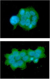 OSTF1 / OSF Antibody - ICC/IF analysis of OSTF1 in MCF7 cells line, stained with DAPI (Blue) for nucleus staining and monoclonal anti-human OSTF1 antibody (1:100) with goat anti-mouse IgG-Alexa fluor 488 conjugate (Green).ICC/IF analysis of OSTF1 in A431 cells line, stained with DAPI (Blue) for nucleus staining and monoclonal anti-human OSTF1 antibody (1:100) with goat anti-mouse IgG-Alexa fluor 488 conjugate (Green).