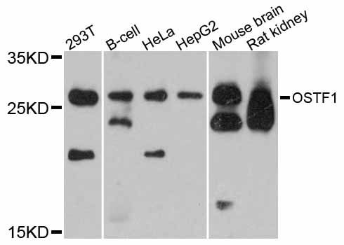 OSTF1 / OSF Antibody - Western blot analysis of extracts of various cell lines, using OSTF1 antibody at 1:3000 dilution. The secondary antibody used was an HRP Goat Anti-Rabbit IgG (H+L) at 1:10000 dilution. Lysates were loaded 25ug per lane and 3% nonfat dry milk in TBST was used for blocking. An ECL Kit was used for detection and the exposure time was 30s.