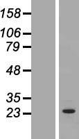 OSTF1 / OSF Protein - Western validation with an anti-DDK antibody * L: Control HEK293 lysate R: Over-expression lysate