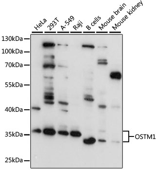 OSTM1 Antibody - Western blot analysis of extracts of various cell lines, using OSTM1 antibody at 1:3000 dilution. The secondary antibody used was an HRP Goat Anti-Rabbit IgG (H+L) at 1:10000 dilution. Lysates were loaded 25ug per lane and 3% nonfat dry milk in TBST was used for blocking. An ECL Kit was used for detection and the exposure time was 10s.