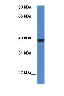 OTC Antibody - OTC antibody Western blot of Mouse Liver lysate. Antibody concentration 1 ug/ml.  This image was taken for the unconjugated form of this product. Other forms have not been tested.