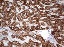 OTC Antibody - IHC of paraffin-embedded Human liver tissue using anti-OTC mouse monoclonal antibody. (Heat-induced epitope retrieval by 10mM citric buffer, pH6.0, 120°C for 3min).