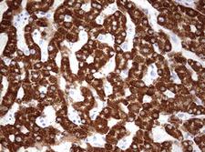 OTC Antibody - IHC of paraffin-embedded Human liver tissue using anti-OTC mouse monoclonal antibody. (Heat-induced epitope retrieval by 10mM citric buffer, pH6.0, 120°C for 3min).