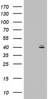 OTC Antibody - HEK293T cells were transfected with the pCMV6-ENTRY control (Left lane) or pCMV6-ENTRY OTC (Right lane) cDNA for 48 hrs and lysed. Equivalent amounts of cell lysates (5 ug per lane) were separated by SDS-PAGE and immunoblotted with anti-OTC.