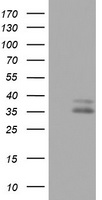 OTC Antibody - HEK293T cells were transfected with the pCMV6-ENTRY control (Left lane) or pCMV6-ENTRY OTC (Right lane) cDNA for 48 hrs and lysed. Equivalent amounts of cell lysates (5 ug per lane) were separated by SDS-PAGE and immunoblotted with anti-OTC.