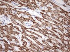 OTC Antibody - IHC of paraffin-embedded Human liver tissue using anti-OTC mouse monoclonal antibody. (Heat-induced epitope retrieval by 10mM citric buffer, pH6.0, 120°C for 3min).