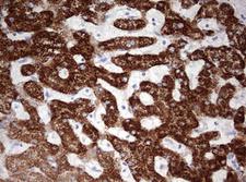 OTC Antibody - IHC of paraffin-embedded Human liver tissue using anti-OTC mouse monoclonal antibody. (Heat-induced epitope retrieval by 10mM citric buffer, pH6.0, 120°C for 3min).