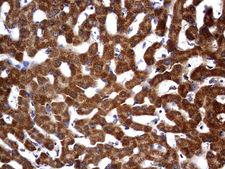 OTC Antibody - IHC of paraffin-embedded Human liver tissue using anti-OTC mouse monoclonal antibody. (Heat-induced epitope retrieval by 1 mM EDTA in 10mM Tris, pH9.0, 120°C for 3min).