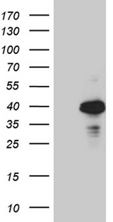 OTC Antibody - HEK293T cells were transfected with the pCMV6-ENTRY control. (Left lane) or pCMV6-ENTRY OTC. (Right lane) cDNA for 48 hrs and lysed. Equivalent amounts of cell lysates. (5 ug per lane) were separated by SDS-PAGE and immunoblotted with anti-OTC. (1:2000)