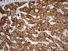 OTC Antibody - Immunohistochemical staining of paraffin-embedded Human liver tissue within the normal limits using anti-OTC mouse monoclonal antibody. (Heat-induced epitope retrieval by 1mM EDTA in 10mM Tris buffer. (pH8.5) at 120°C for 3 min. (1:500)