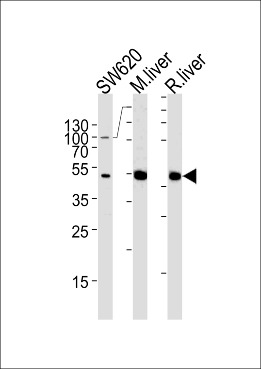 OTC Antibody - OTC Antibody western blot of SW620 cell line and mouse liver, rat liver lysates (35 ug/lane). The OTC antibody detected the OTC protein (arrow).