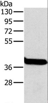 OTC Antibody - Western blot analysis of Mouse liver tissue, using OTC Polyclonal Antibody at dilution of 1:800.