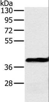 OTC Antibody - Western blot analysis of Mouse liver tissue, using OTC Polyclonal Antibody at dilution of 1:650.